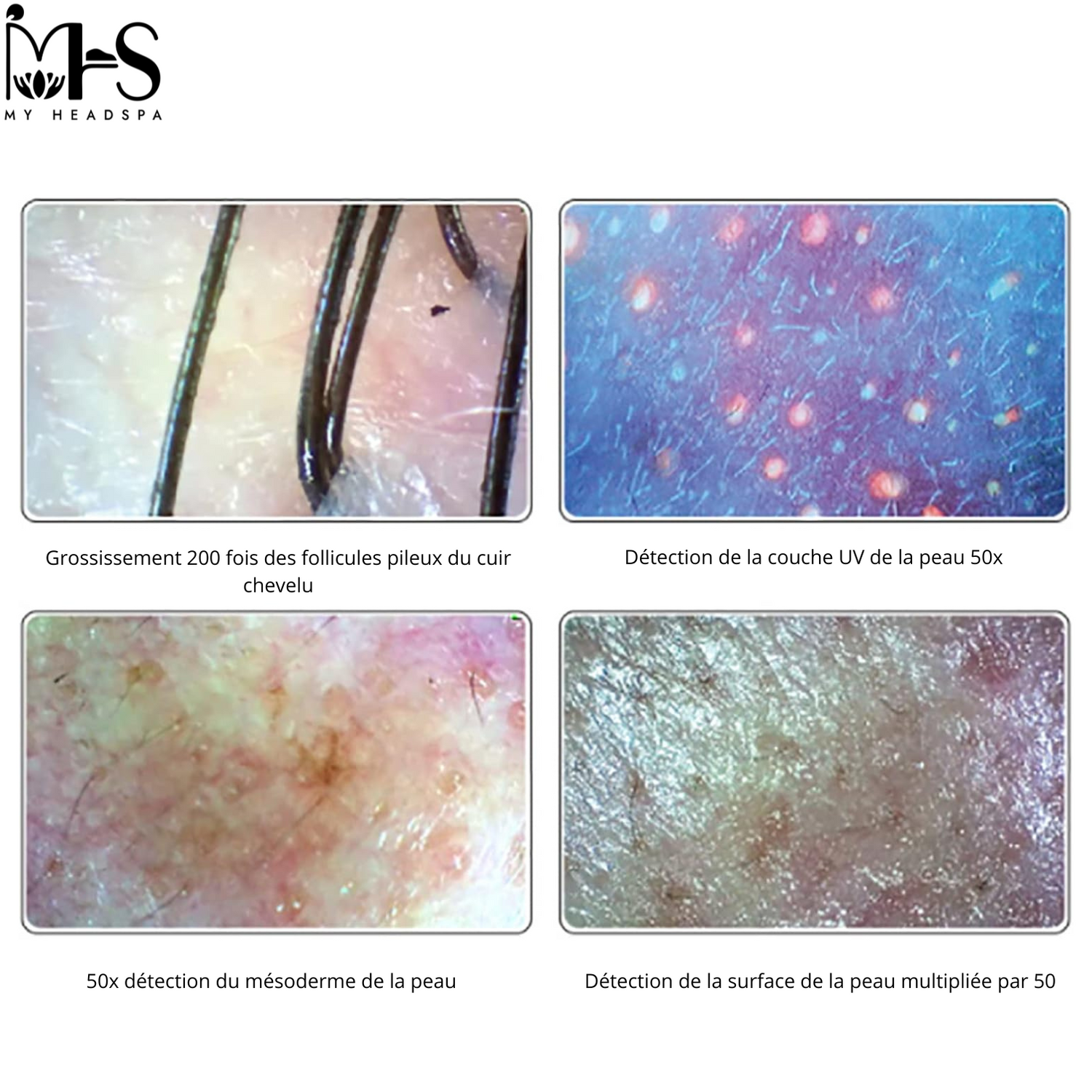 Professional Hair and Skin Analyzer - Headspa